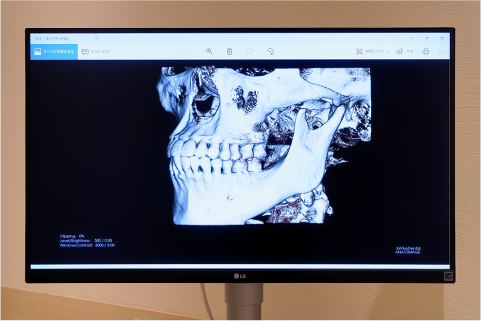 説明用モニター