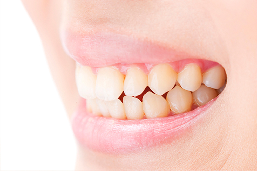 歯ぎしり・食いしばり