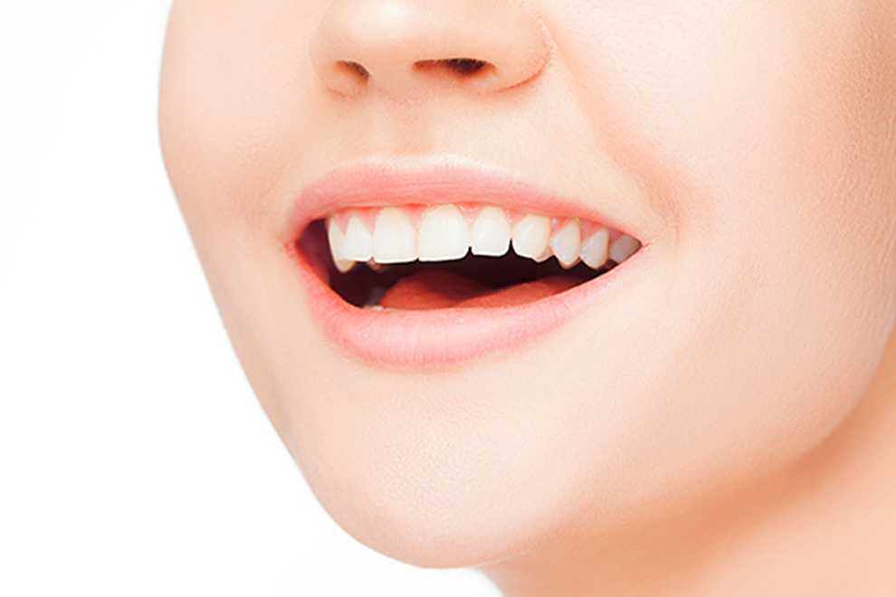 ホワイトニング